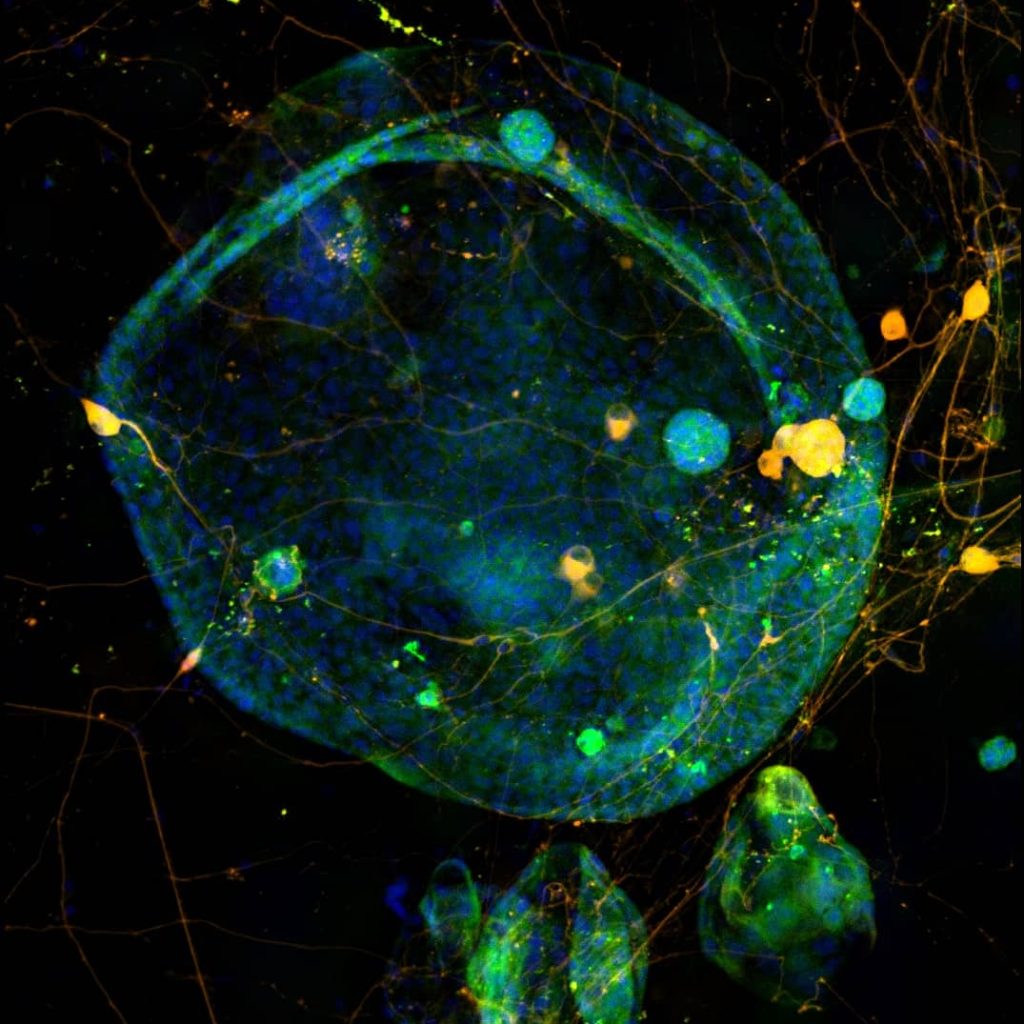 cancer-neuroscience